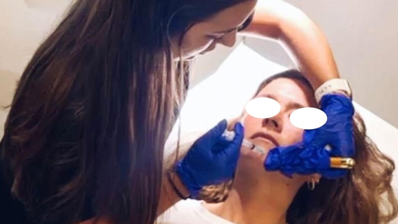 Infiltración facial realizada por una cirujana en la consulta de Tricap