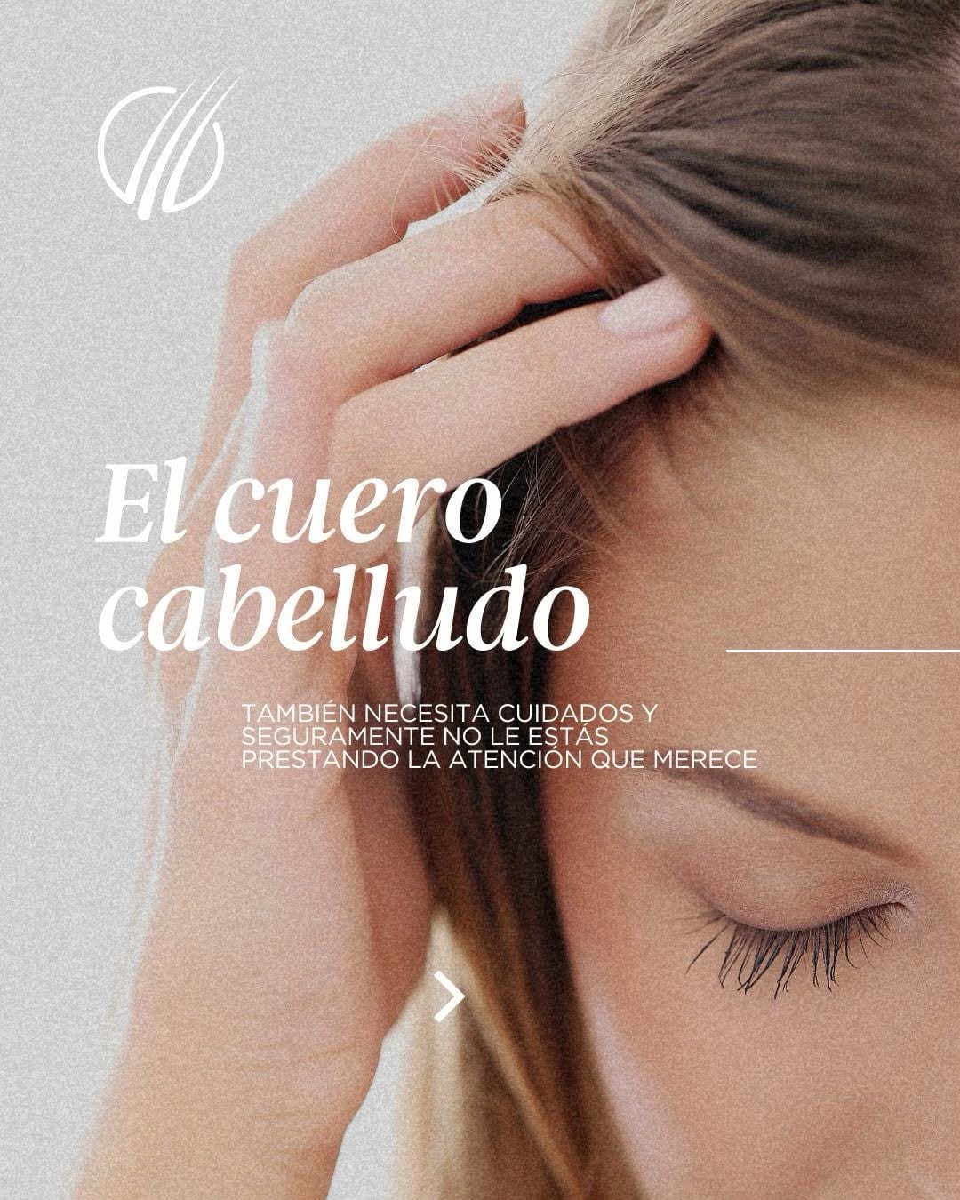 Una mujer se aparta el pelo para mostrar el cuero cabelludo